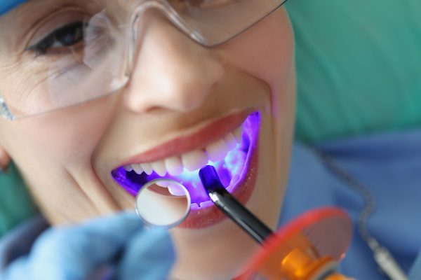 Dental Hygienist